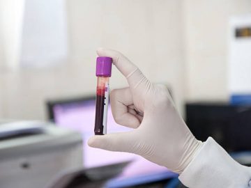 Liquid Biopsy