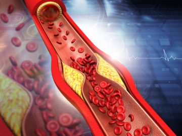 Familiar Hypercholesterolemia (FH) panel